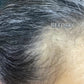 New Customers- Complete Hair Restoration Kit