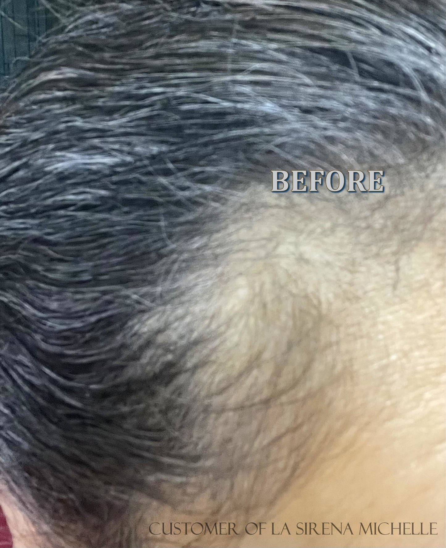 New Customers- Complete Hair Restoration Kit