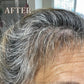 New Customers- Complete Hair Restoration Kit