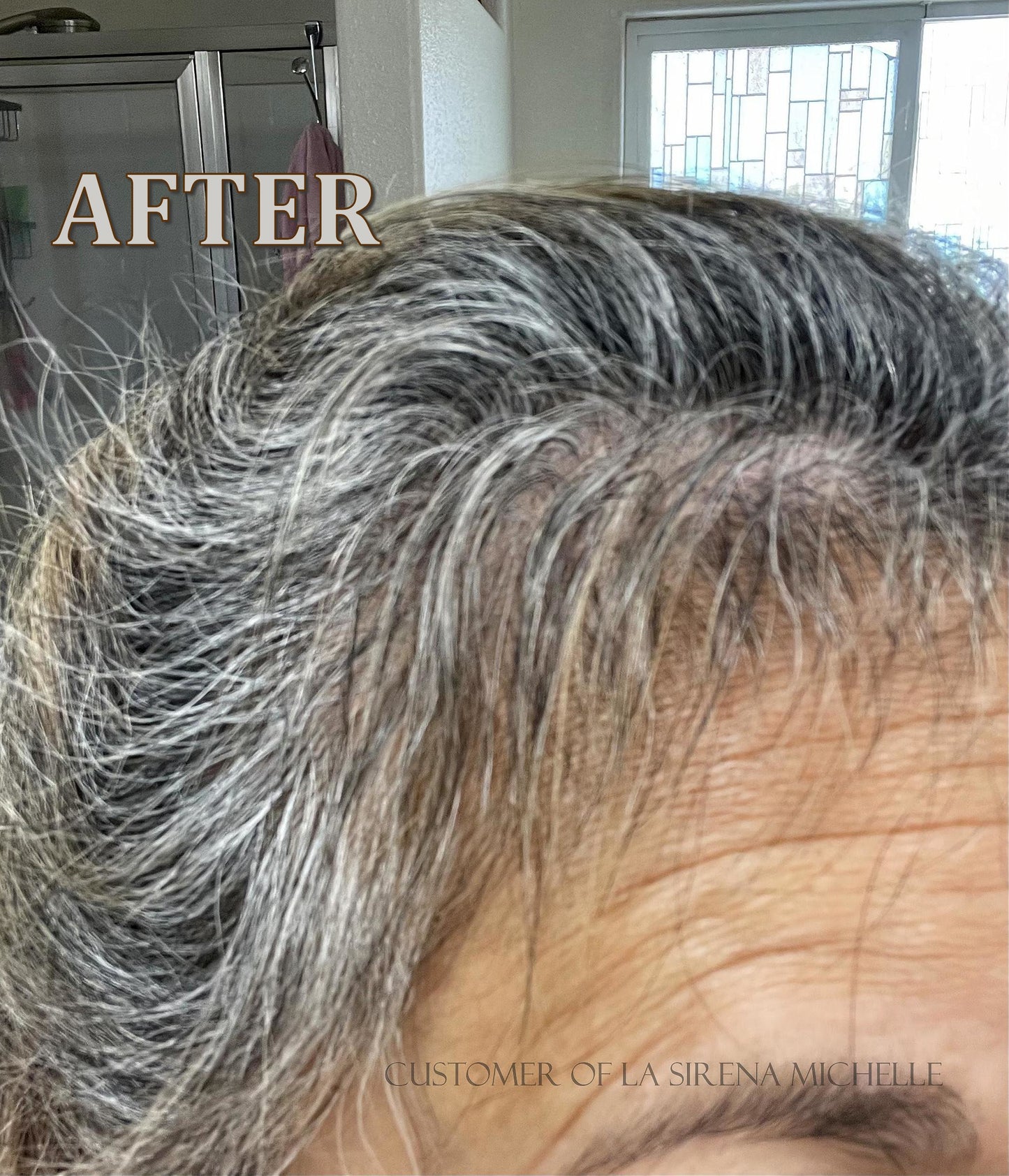 New Customers- Complete Hair Restoration Kit